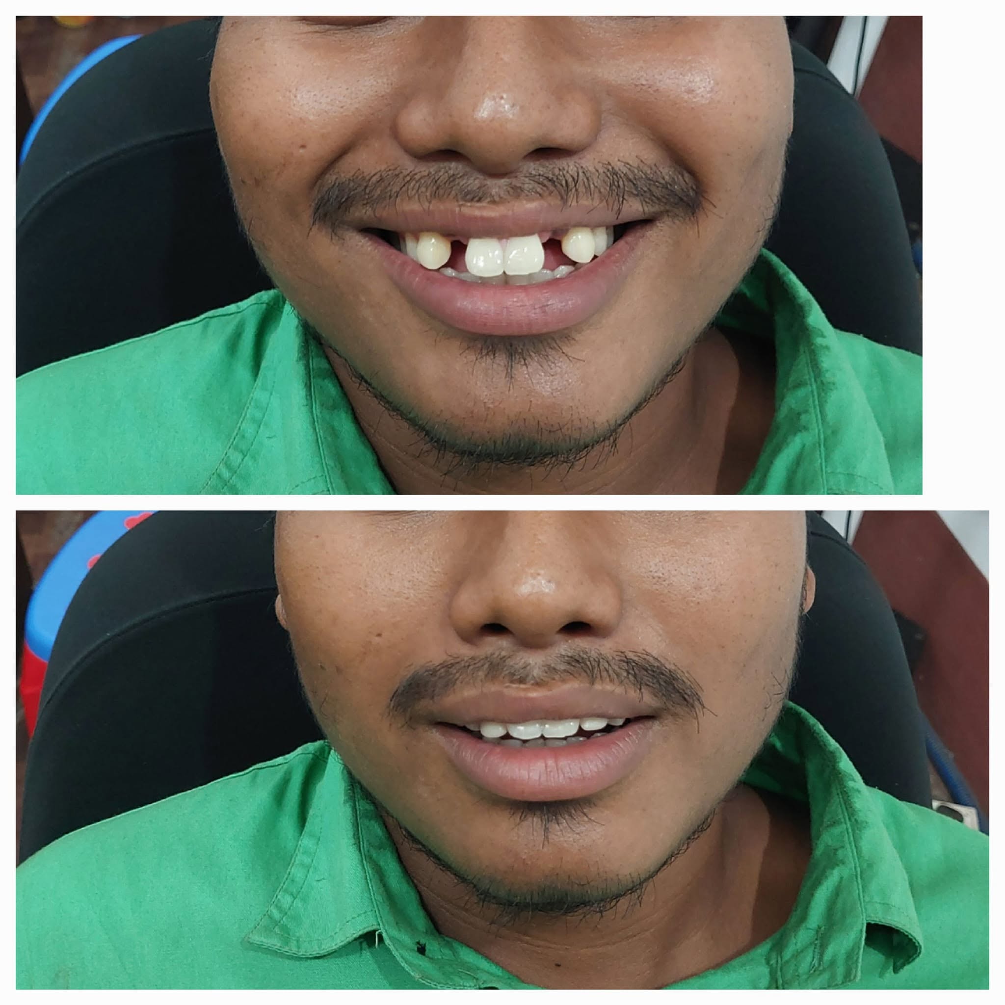 Clinical Case 12 - Dr. Dipayan Bhattacharya
