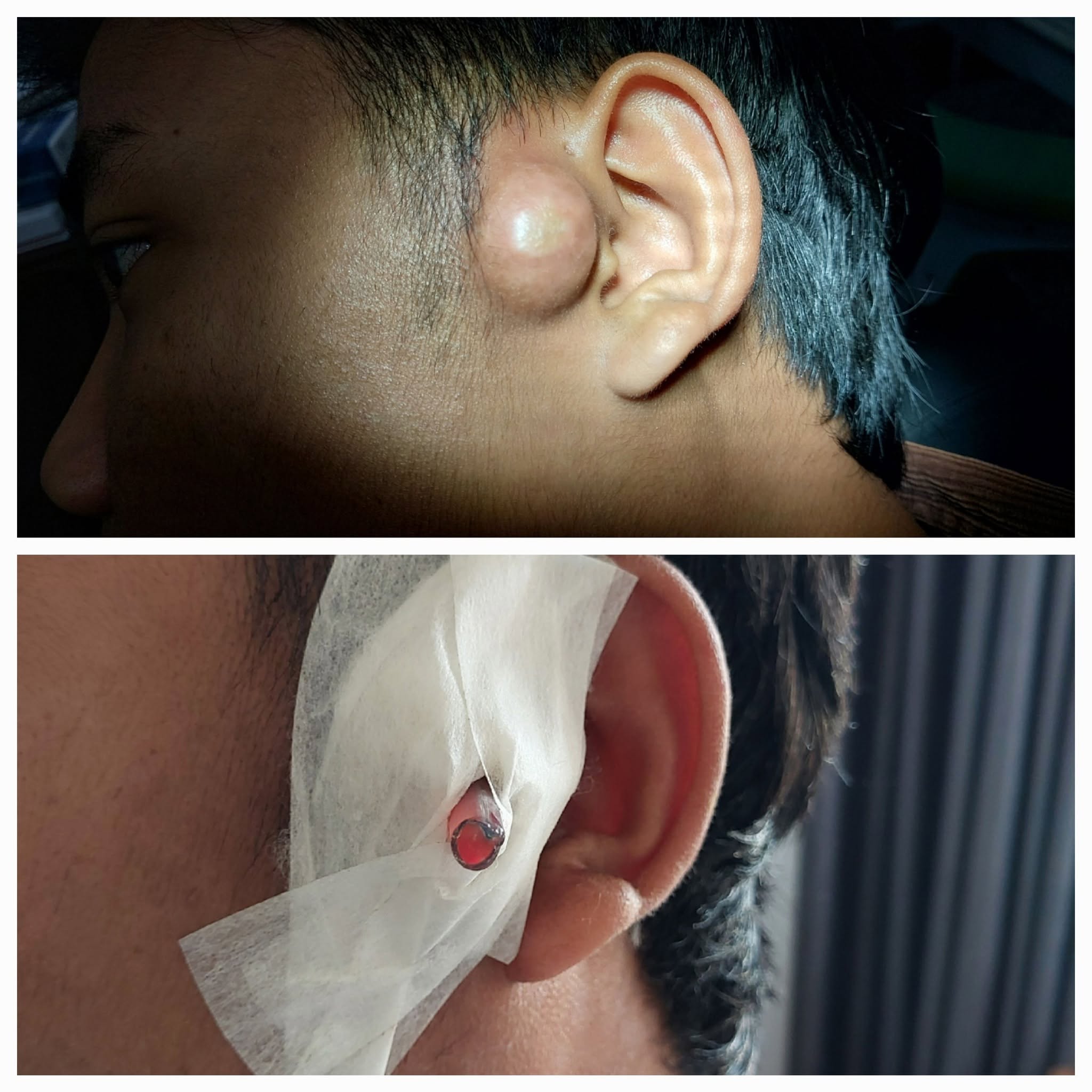 Clinical Case 02 - Dr. Dipayan Bhattacharya