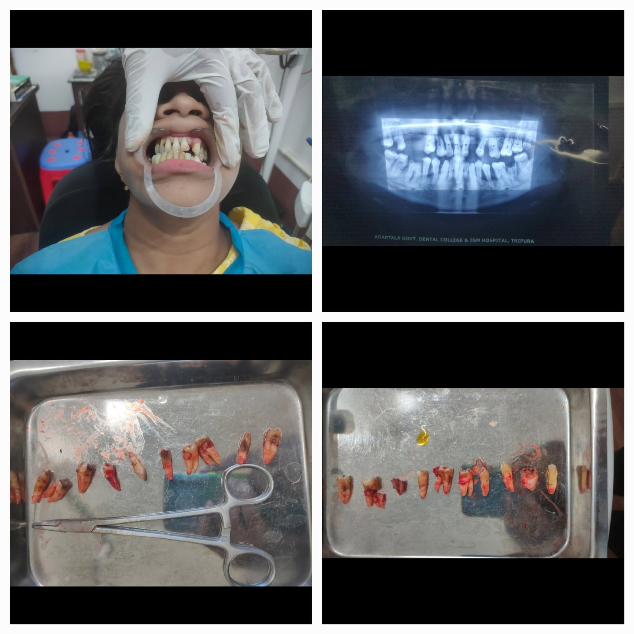 Clinical Case 06 - Dr. Dipayan Bhattacharya