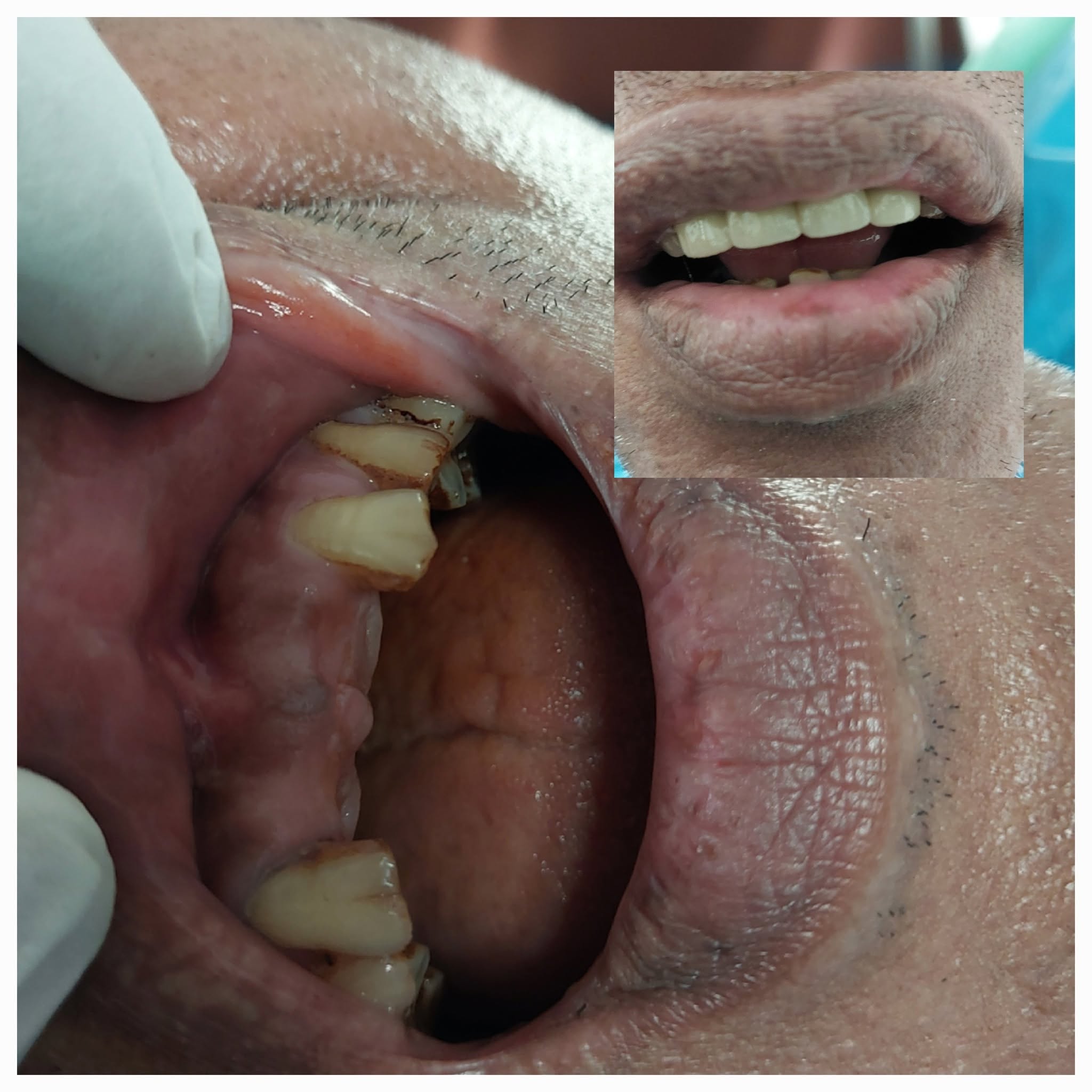 Clinical Case 07 - Dr. Dipayan Bhattacharya