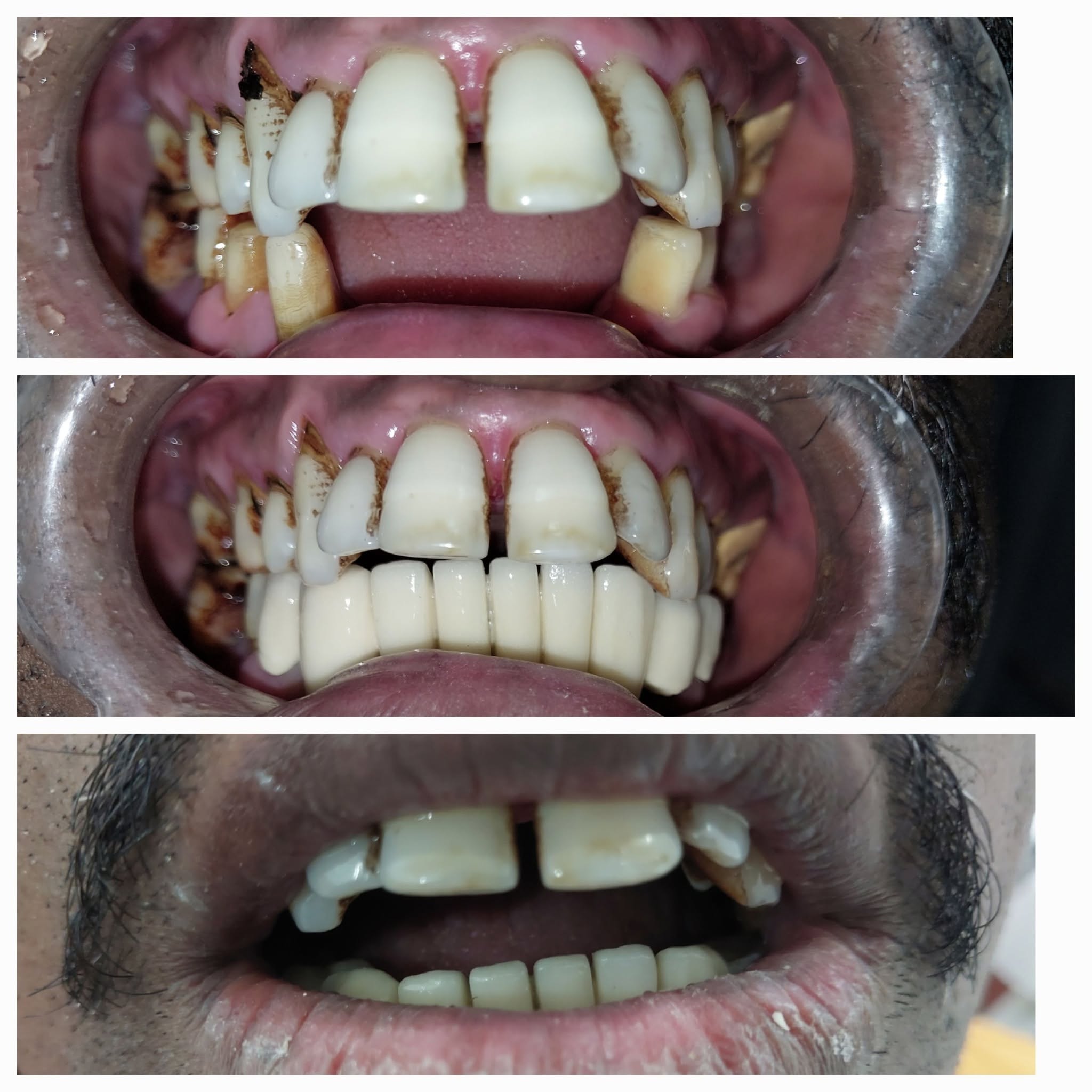 Clinical Case 08 - Dr. Dipayan Bhattacharya